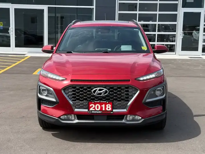 Hyundai Kona 2018 photo 3