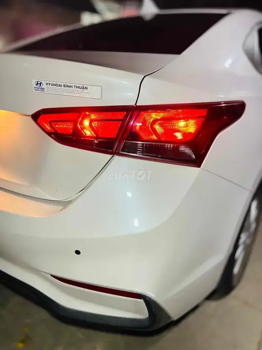 Hyundai Accent 2018 photo 3