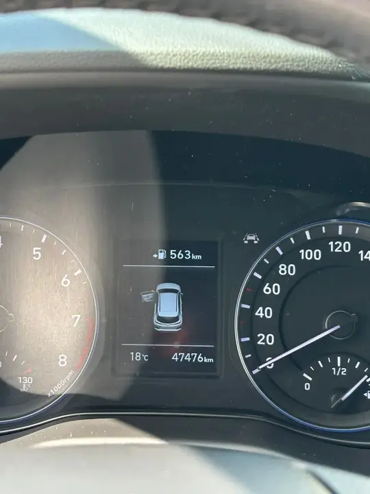 Hyundai Kona 2017 photo 3